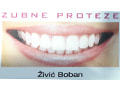 Zubne proteze Živić