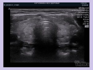 ultrazvuk-srca-dr-milan-crnobaric-298afe-3.jpg