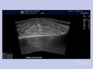 ultrazvuk-srca-dr-milan-crnobaric-298afe-5.jpg