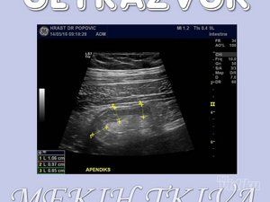 ultrazvuk-srca-dr-milan-crnobaric-298afe-6.jpg