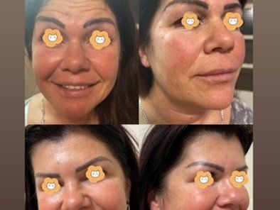 Beauty Standard Lab Centar