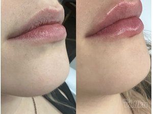 Beauty Standard Lab Centar