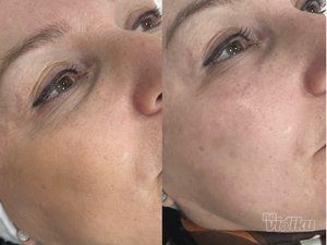 Beauty Standard Lab Centar