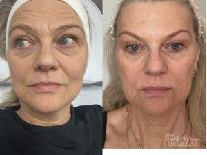 Beauty Standard Lab Centar