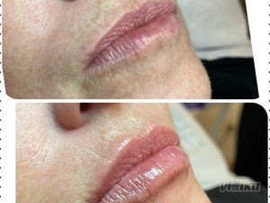 Beauty Standard Lab Centar