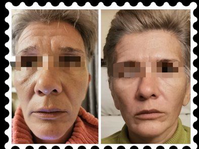 Beauty Standard Lab Centar