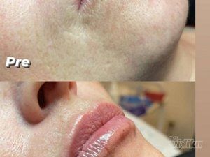 Beauty Standard Lab Centar