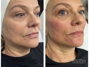 Beauty Standard Lab Centar