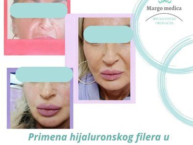 Dermatološka odrinacija Margo Medica