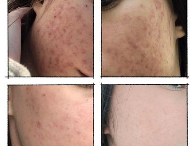 Dermatološka odrinacija Margo Medica