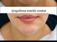 Ordinacija Opšte i Anti Aging medicine Apolona