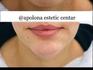 Ordinacija Opšte i Anti Aging medicine Apolona