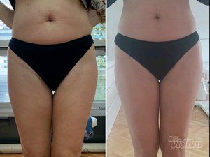 Ordinacija Opšte i Anti Aging medicine Apolona