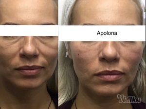 Ordinacija Opšte i Anti Aging medicine Apolona