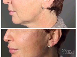 Ordinacija Opšte i Anti Aging medicine Apolona