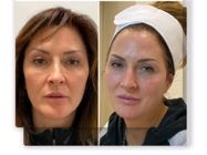 Ordinacija Opšte i Anti Aging medicine Apolona