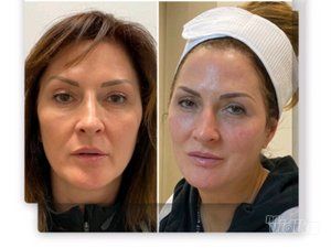 Ordinacija Opšte i Anti Aging medicine Apolona