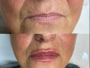 Ordinacija Opšte i Anti Aging medicine Apolona