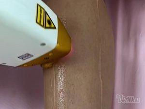 Beauty Rose laser centar