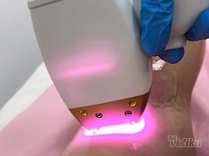 Beauty Rose laser centar