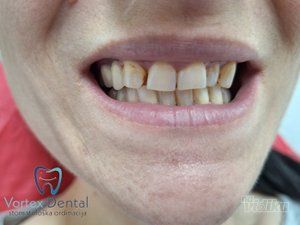 Vortex Dental stomatološka ordinacija