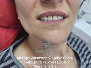 Vortex Dental stomatološka ordinacija