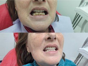 Vortex Dental stomatološka ordinacija