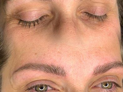 Manja Laser Centar