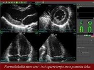 specijalisticki-pregled-beograd-kardiologija-u-beogradu-658399-2.jpg
