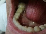 stomatoloska-protetika-parodontologija-ortodoncija-novi-sad-b5c000.jpg