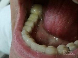 stomatoloska-protetika-parodontologija-ortodoncija-novi-sad-b5c000.jpg