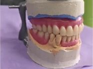 stomatoloska-protetika-parodontologija-ortodoncija-novi-sad-b5c000-b4253acb-1.jpg