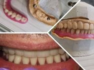stomatoloska-protetika-parodontologija-ortodoncija-novi-sad-b5c000-ea56fdfe-1.jpg