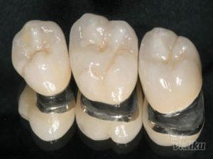 specijalisticka-stomatoloska-ordinacija-dr-pap-slike-0bf250-4f1a024b-1.jpg