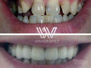 stomatoloska-ordinacija-winner-smile-slike-357618-11.jpg