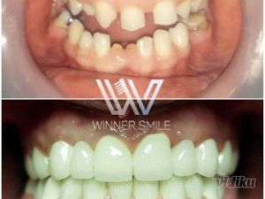 stomatoloska-ordinacija-winner-smile-slike-357618-9.jpg