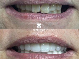 Dedentika stomatološka ordinacija