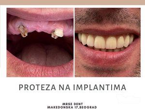 stomatoloska-ordinacija-mrse-dent-slike-c259c1-1.jpg
