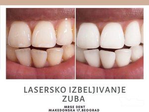 stomatoloska-ordinacija-mrse-dent-slike-c259c1-2.jpg
