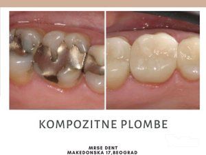 stomatoloska-ordinacija-mrse-dent-slike-c259c1-3.jpg