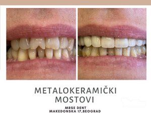stomatoloska-ordinacija-mrse-dent-slike-c259c1-4.jpg
