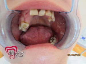 stomatoloska-ordinacija-dental-milosevic-7f08b7-f9285e28-1.jpg