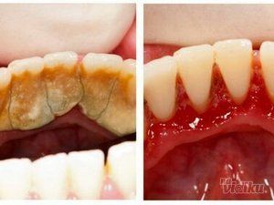 stomatoloska-ordinacija-dental-milosevic-ea3576-4b34948c-1.jpg