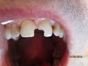 stomatoloska-ordinacija-dental-milosevic-f086f9.jpg