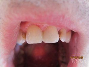 stomatoloska-ordinacija-dental-milosevic-f086f9-a0af2300-1.jpg