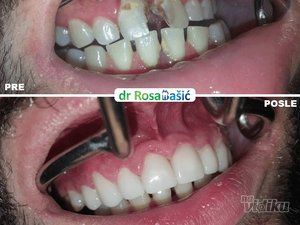 stomatoloska-ordinacija-dr-rosa-basic-40c0d5-8f8705e6-1.jpg