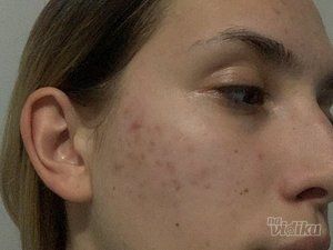 Kozmetički studio Lela Derm