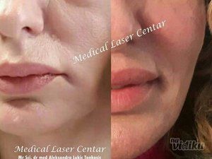 estetic-anti-aging-medical-laser-centar-6dced2-2.jpg