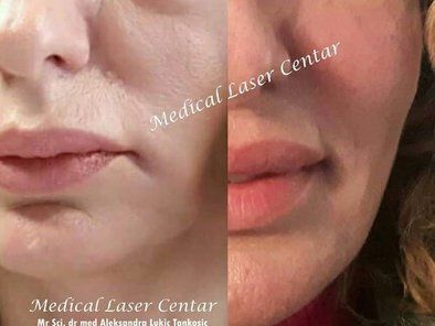 Estetic Anti Aging Medical Laser Centar
