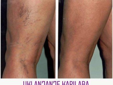 Estetic Anti Aging Medical Laser Centar